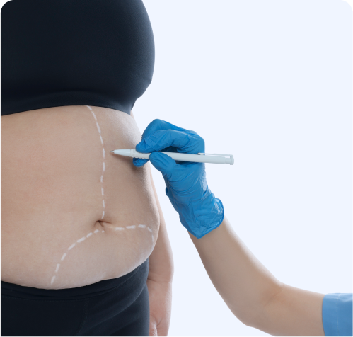 Endoscopia Bariátrica