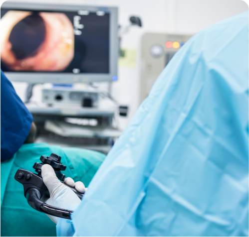 Endoscopia Oncológica